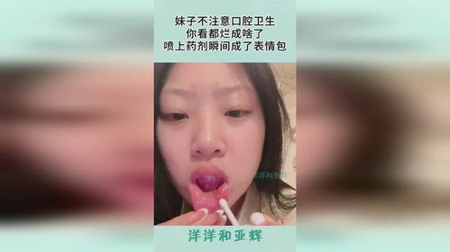  妹子不注意口腔卫生,你看都烂成啥了,喷上药剂瞬间成了表情包