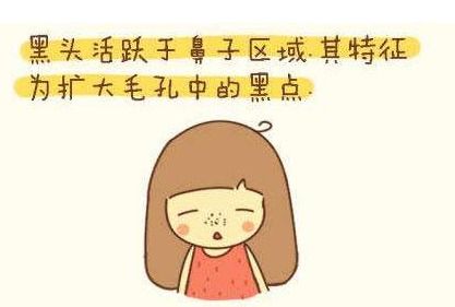  黑头粉刺正确的去黑头方法,用什么才能去黑头