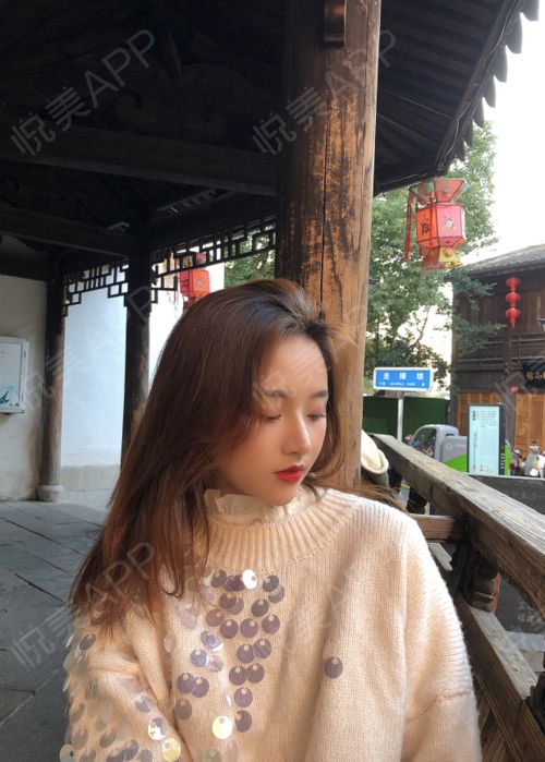  这两天我广州的小姐妹来长沙找我玩啦,我们两个不也是...鼻综合悦美整形