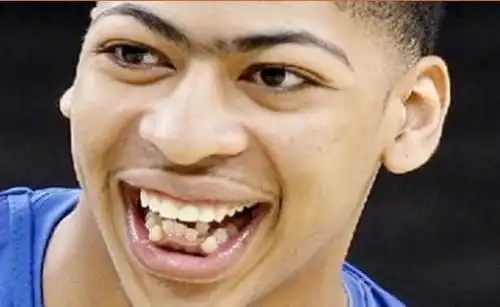  nba颜值最低的十位球员