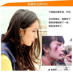  杨幂刘诗诗姚笛郑爽女星整容前巨丑无法直视