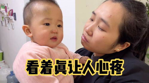  一岁儿子摔得鼻青脸肿,丈母娘气坏了,最后宝宝的举动让人暖心