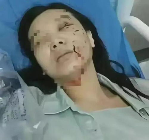  狗咬伤女子索赔800万,狗主人拒绝赔偿,怒杀当事狗