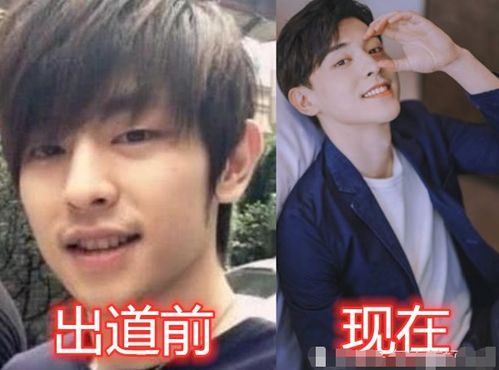  有一种整容叫公司包装,李现判若两人,看到任嘉伦经历了啥
