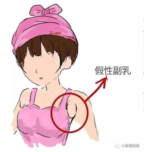  穿错内衣,危害有多大不要出问题了,才意识到胸部健康的重要性