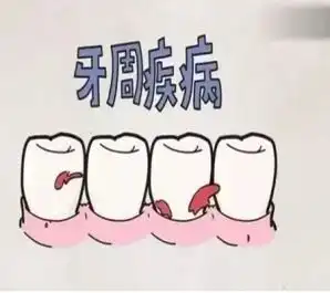  为啥你每次牙疼都说上火了,不能吃辣