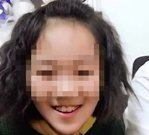  山西一12岁女孩遭继母虐待,皮肤多处溃烂感染,被虐打成植物人