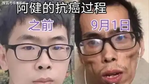  直肠癌到底有多可怕知名网红阿健去世,患癌一年,瘦骨嶙峋,判若两人...