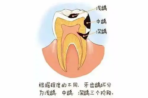  都是同一个医生做的假牙,为什么效果就不一样呢