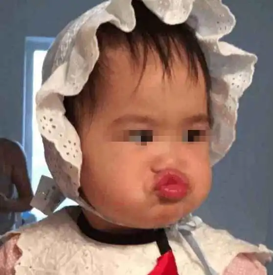  3岁女儿总爱嘟嘴,妈妈觉得很萌,奶奶看到后却忙让送去医院