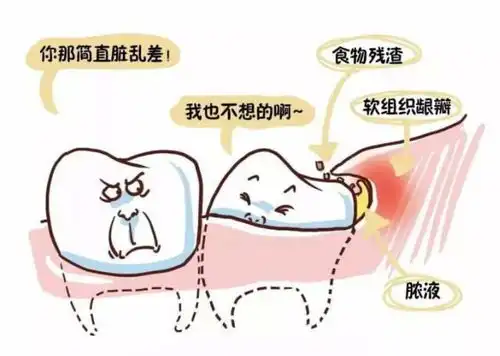  你还在说牙疼不是病当心要了你的命