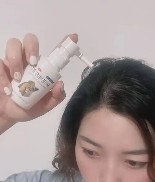  请问什么牌子的米诺地尔效果好