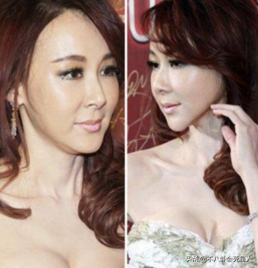  6大琼瑶女神20年颜值对比有人花期短颜值垮,有人整容过度