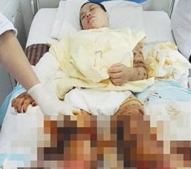 安徽一女子被狗咬骗捐案续当地电视台一工作人员被控制组图