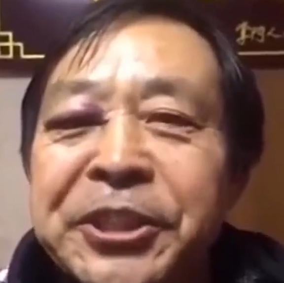  功夫骗子马保国用太极拳骗老外,回国被揍鼻青脸肿