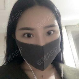  这几天,天气好差,雾霾严重每天都戴着口罩出门,都不...隆鼻悦美整形