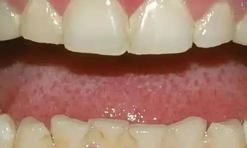  这十种常见口腔疾病,你有遇到过么
