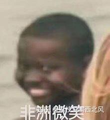  脸上有黑痘印,喝柠檬水会加重痘印吗