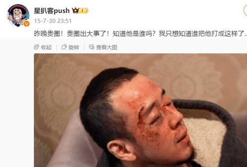  50岁杨坤湖南演出被人胖揍鼻青脸肿本人头裹纱布出镜回应