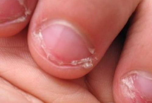  小孩子咬指甲竟是因为这样,聪明的父母早知道怎么做了