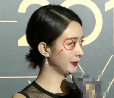 明星走红毯,赵丽颖被冻哭,林更新难掩愁容,而他戳中我一年笑点