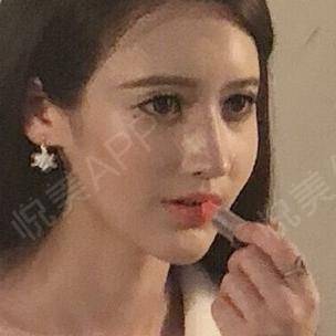  好看的人,运气不会太差哦自从我做了眼睛和鼻子之后...隆鼻悦美整形