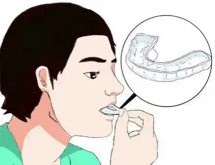  张不开嘴腮帮子咔咔响可能是颞下颌关节紊乱病