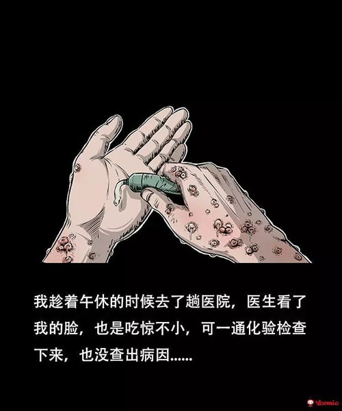  中国民间灵异漫画怪病出现奇怪恶心的疙瘩