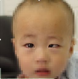  为什么宝宝的眼睛看起来像斗鸡眼,儿科医生却说不用担心