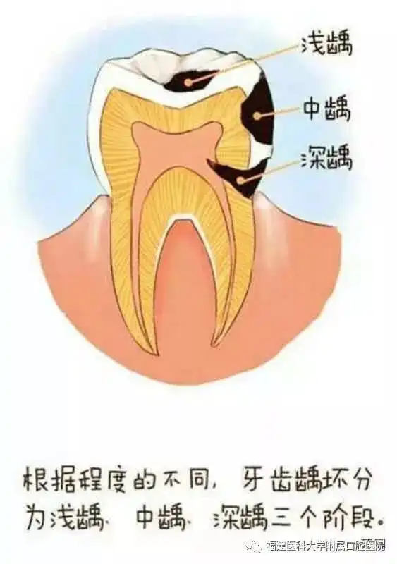  都是同一个医生做的假牙,为什么效果就不一样呢