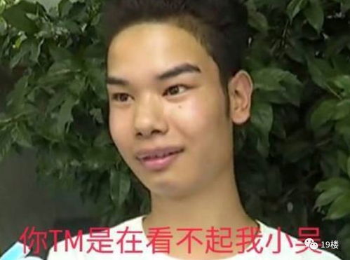  热议刷爆朋友圈的发际线男孩表情包,你收藏了吗本尊我不想做网红