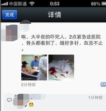  唐嫣深夜受伤送医院,经纪人否认为情自残,二人甜蜜情史在回顾