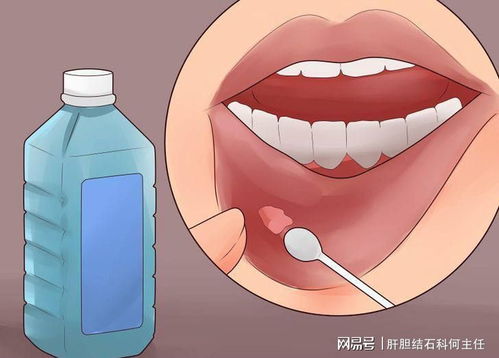  口疮疼痛怎么办口疮怎么样好得快吃维生素b2能治好口疮么