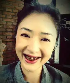  娱乐圈扮丑明星谁最拼,蒋欣赵丽颖均上榜