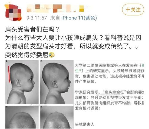  圆头像扁头有福气圆头比扁头更聪明原来都不对