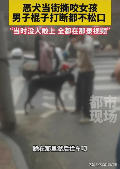  认怂了湖南恶犬咬穿女孩的腿,狗主人身份曝光,面临巨额医药费