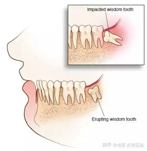  科普你的牙疼,我的心疼