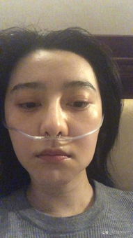  范冰冰高原反应那么严重还不愿离开流鼻血牙龈肿痛几天不能吃饭