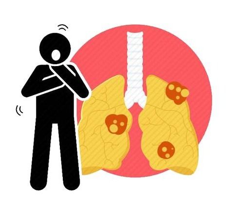  南京疫情传播链继续防疫戴口罩太闷怎么办口罩汗湿还能用吗