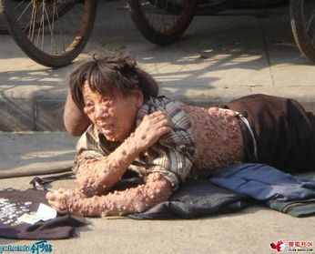  请问这是什么病如图