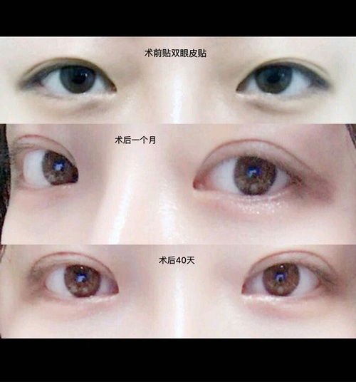  怎样让单眼皮上妆更好看