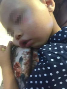  2岁娃店门口被一女子打当场后脑勺着地鼻子出血
