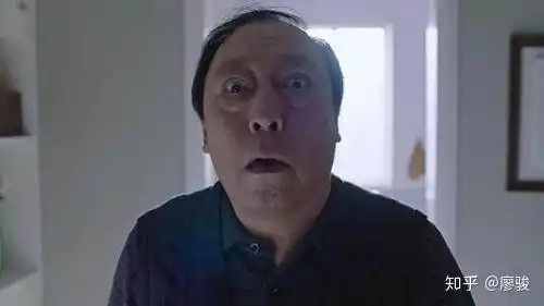  男神没了发际线vs你没了发际线,赶紧补个发际线压压惊