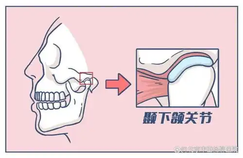  垂医科普颞下颌关节疾病生活中不可忽视的痛
