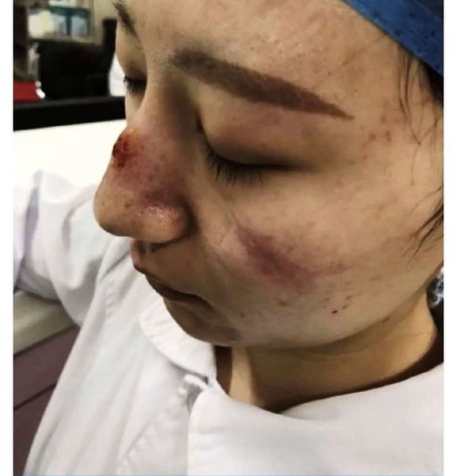  长期戴口罩勤洗手皮肤却越来越差疫情期间,这份护肤方法赶紧收着