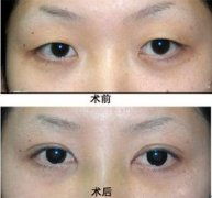 单眼皮口罩头像女生专用